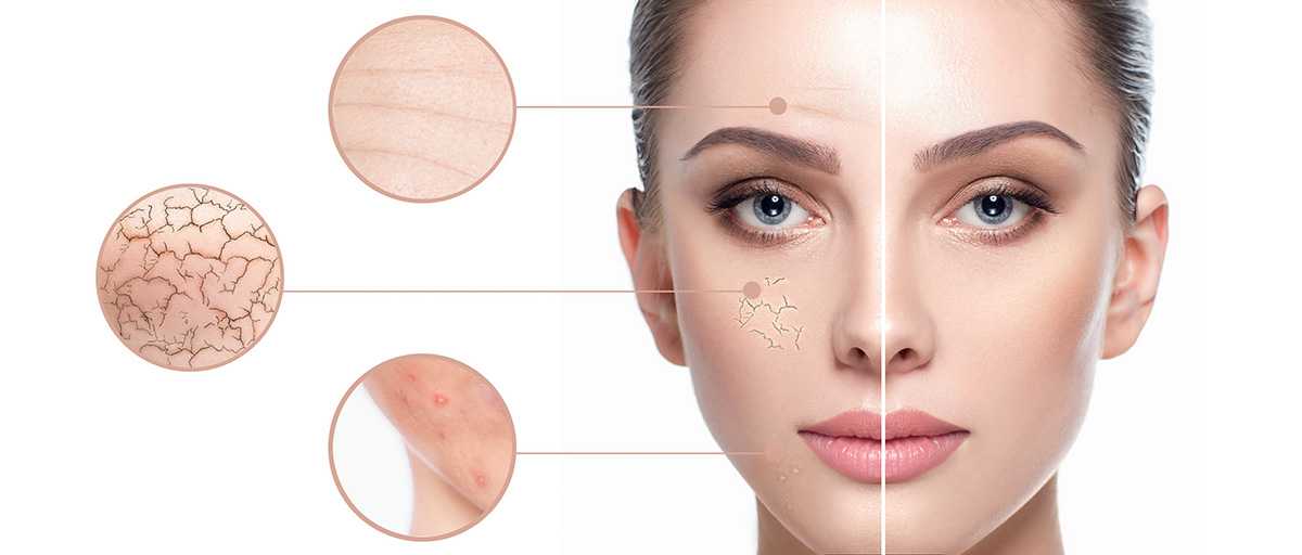 Facial